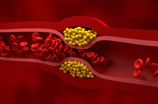 Cholesterol, Triglycerides, and Heart Disease: Separating Myths from Facts